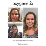 Oxygenetix Oxygenating Foundation - Chakra Colour
