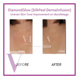 DiamondGlow (SilkPeel Dermalinfusion) Medi-Facial
