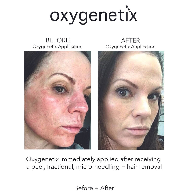 Oxygenetix Oxygenating Foundation - Almond Colour