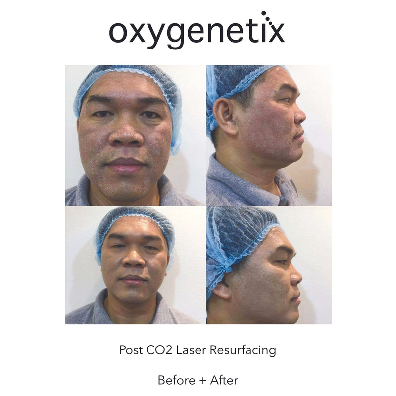 Oxygenetix Oxygenating Foundation - Taupe Colour