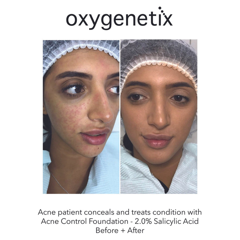 Oxygenetix Acne Control Foundation - Honey Colour