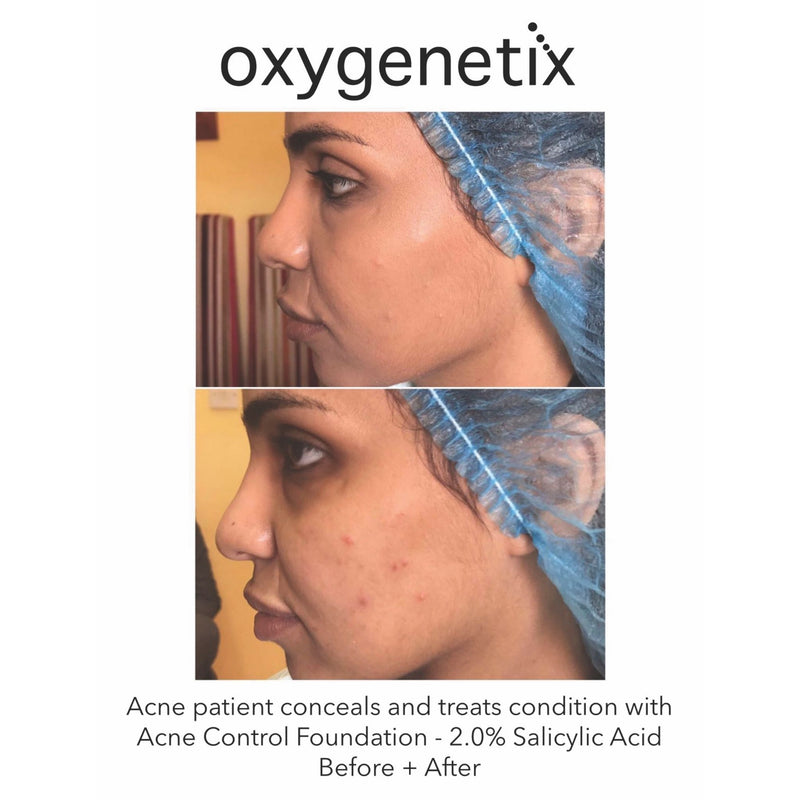 Oxygenetix Acne Control Foundation - Walnut Colour