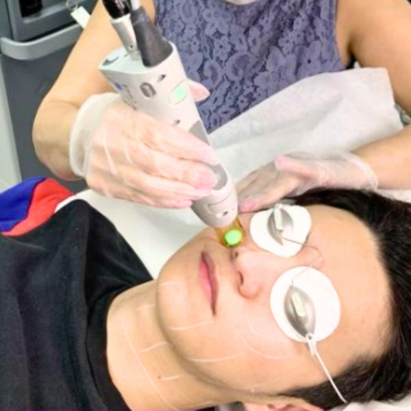 Full Face and Neck -  Men - Laser Hair Removal