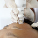 S.TEP Microneedling and Mesotherapy (nano Gold-Plated fine Needles)