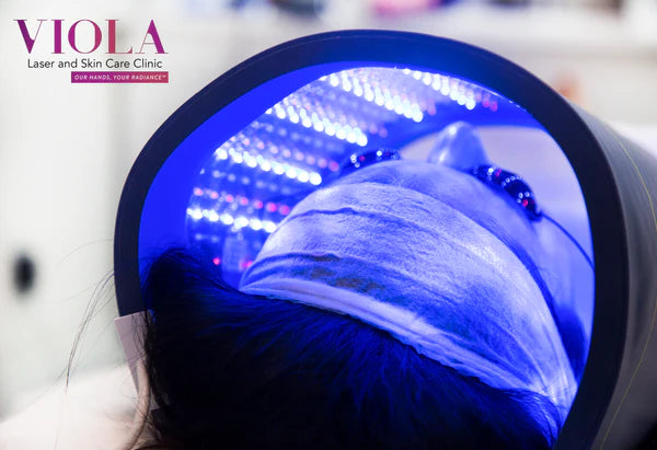 Blue Light Therapy for acne - Add on to any Facial