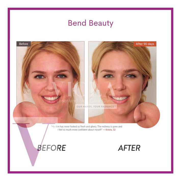 Bend Beauty Renew + Protect- mini softgels