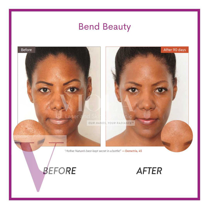Bend Beauty Renew + Protect- mini softgels