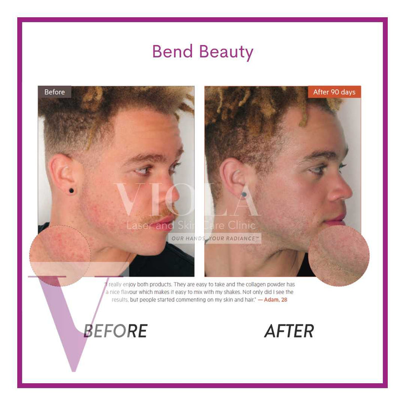 Bend Beauty Marine Collagen + Co-Factors [Unflavoured]